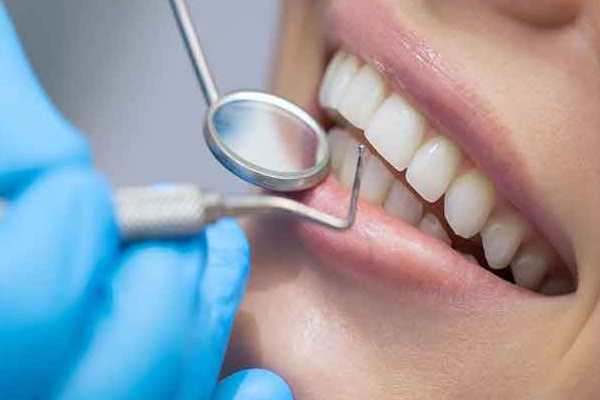 Best Dentist in Punagam, Surat